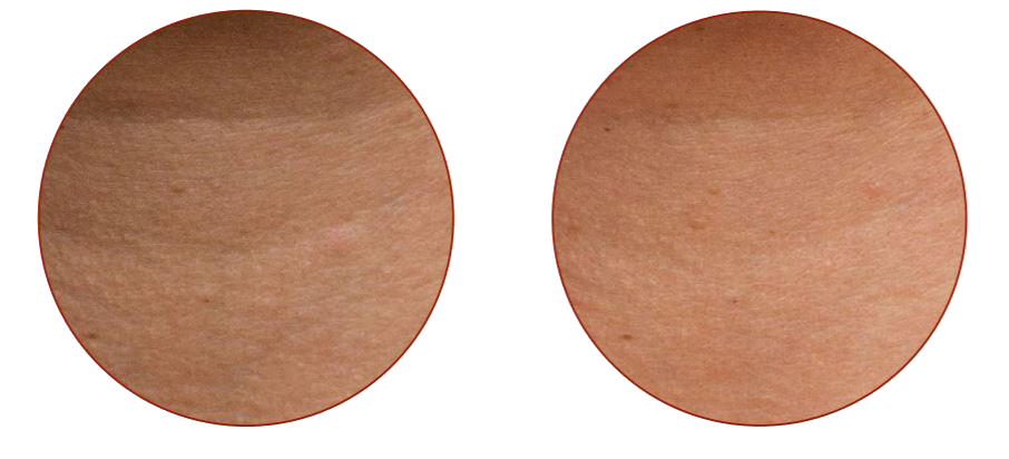 ear3 kopia