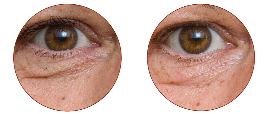 eye1 kopia
